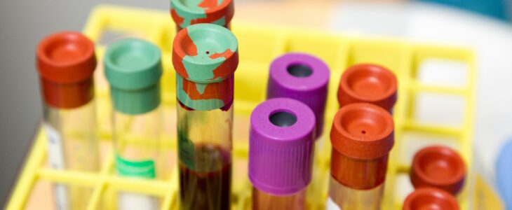 Hemofilia – choroba monarchów